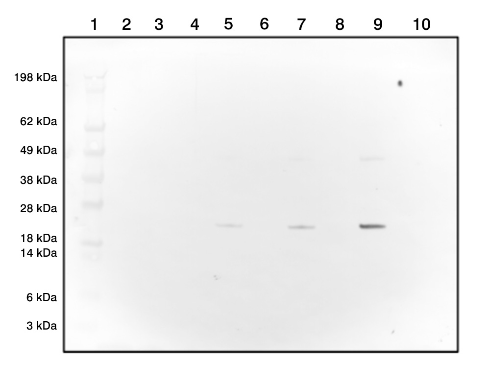 Rabbit Polyclonal Antibodies to HLA