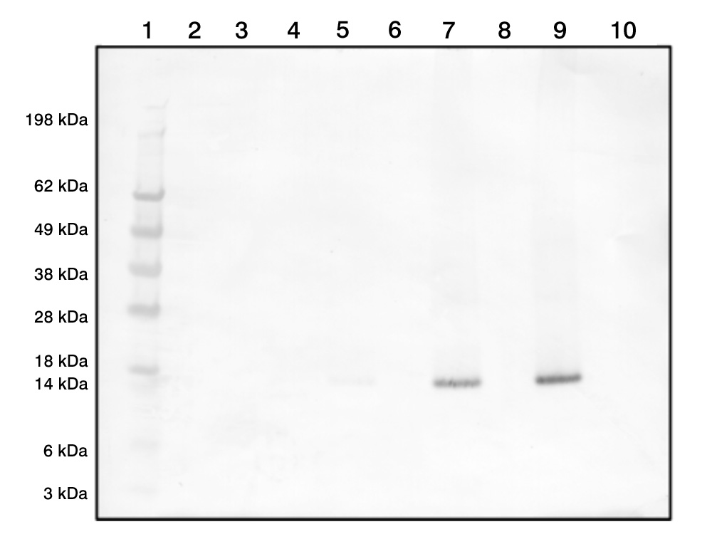 Rabbit Polyclonal Antibodies to Human IFN-Gamma