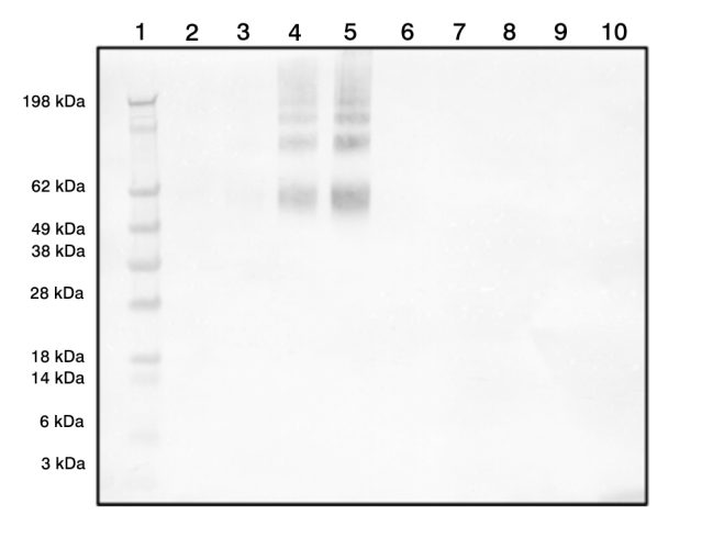 Rabbit Polyclonal Antibodies to Bradykinin