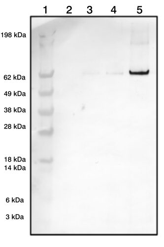 Rabbit Polyclonal Antibodies to Insulin Receptor