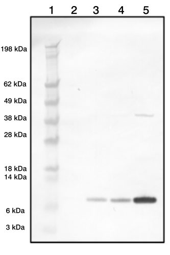 Rabbit Polyclonal Antibodies to Microglobin