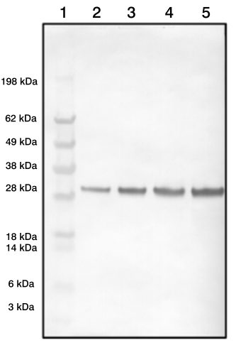 Rabbit Polyclonal Antibodies to Prostate Specific Antigen (PSA)